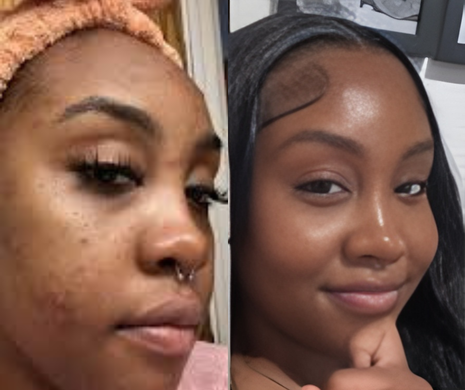 Innervael Liquid Chlorophyll Extract Drops