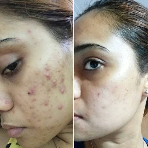 Innervael Liquid Chlorophyll Extract Drops